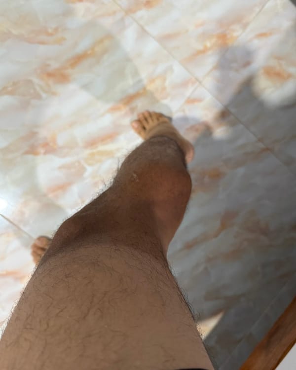 약 복용 후 햇빛 노출이 위험해지는 이유: 광과민성의 원리